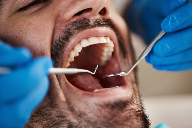 Best Emergency Dental Care for Abscessed Tooth in Nashville, IN